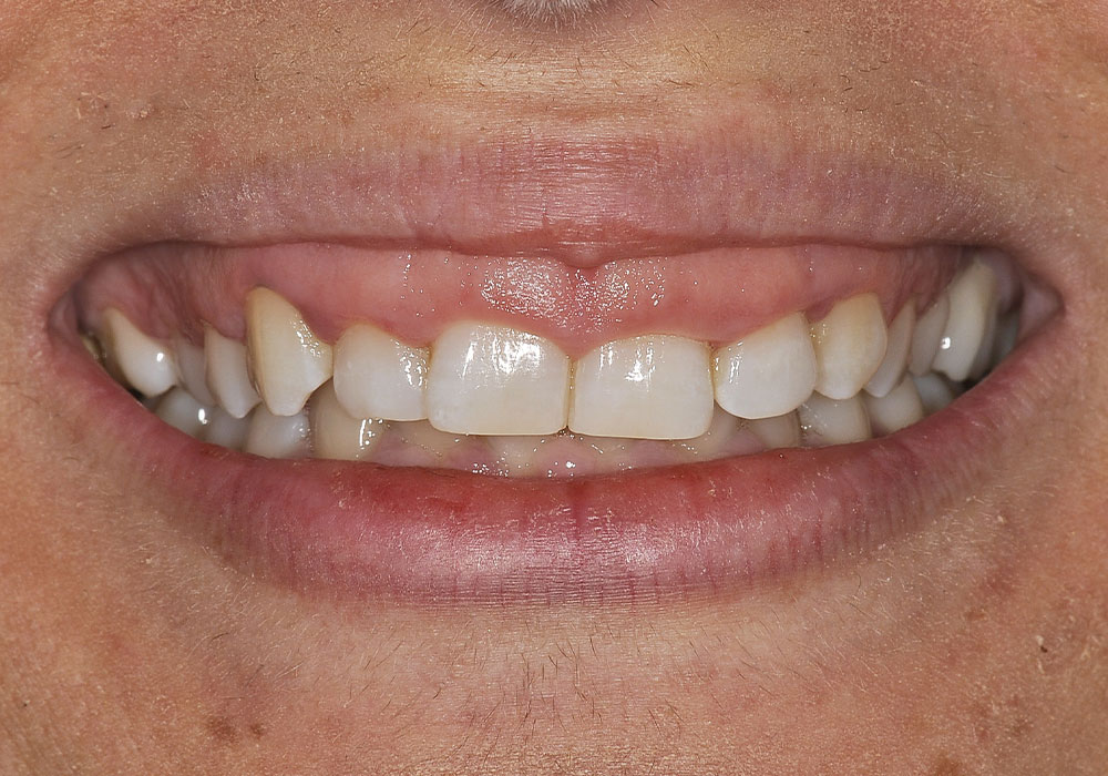estetica-dentale-prima
